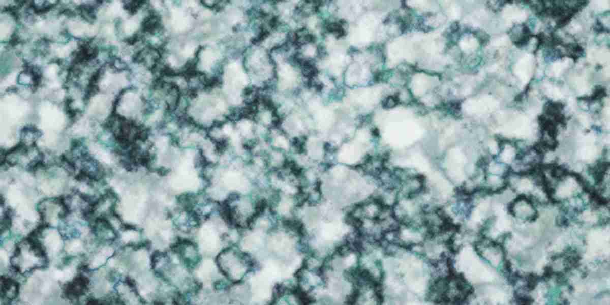 Gold Coin Investment: A Fashionable Strategy To Wealth Preservation